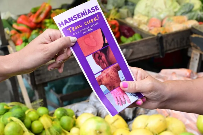 Conscientização sobre Hanseníase: Ação da Saúde no Dia Mundial de Combate Conscientização sobre Hanseníase: Ação da Saúde no Dia Mundial de Combate