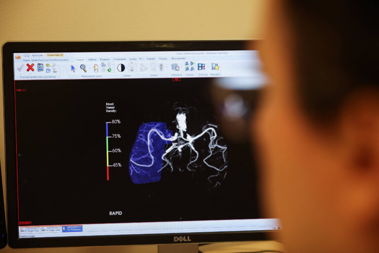 Estudo Revela: IA na Saúde Funciona Bem em Teoria, Mas Não em Prática