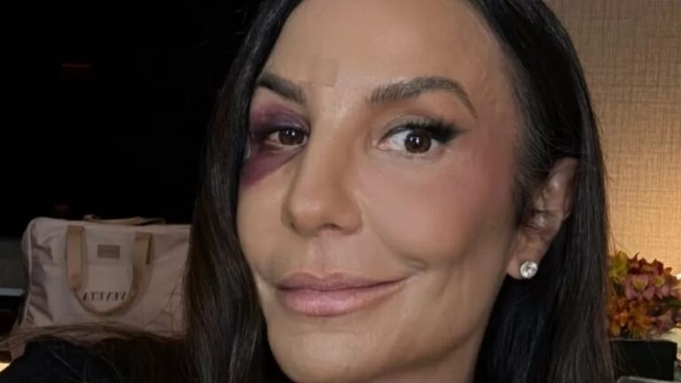 Ivete Sangalo Brilha em Primeiro Show Após Acidente Doméstico na Bahia Ivete Sangalo Brilha em Primeiro Show Após Acidente Doméstico na Bahia