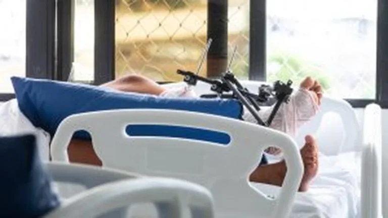Custo de internações por acidentes de moto na Bahia chega a R$148,6 milhões